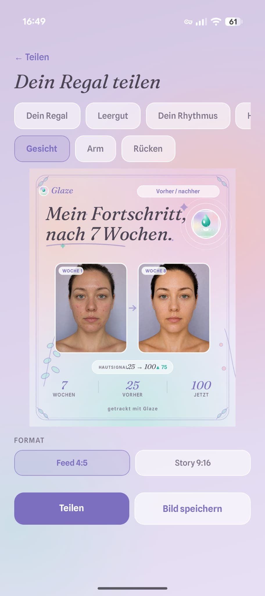 Vergleich